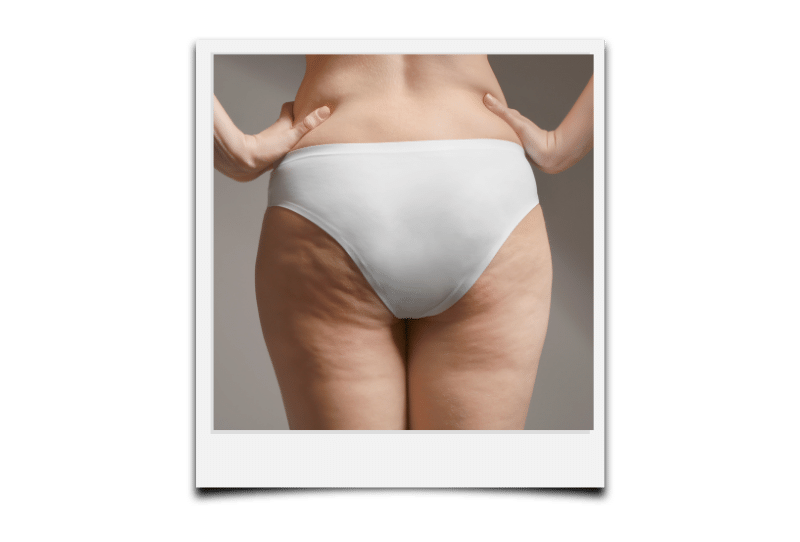 douleurs cuisses